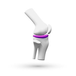 Pain OA - Introduction & Heritage